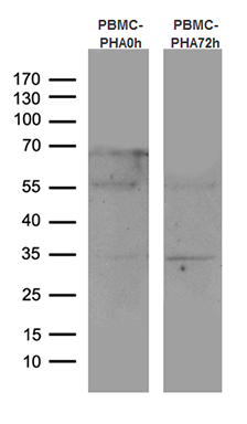 Western blot analysis of human peripheral blood mononuclear cells (PBMCs) by using anti-CTLA4 monoclonal antibody