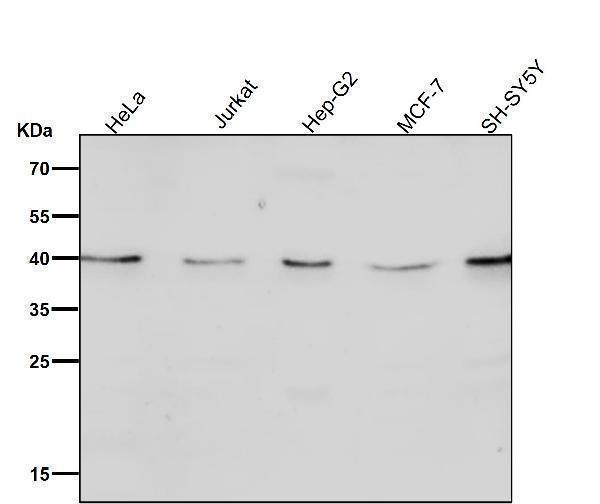 All lanes use the Antibody at 1:2K dilution for 1 hour at room temperature