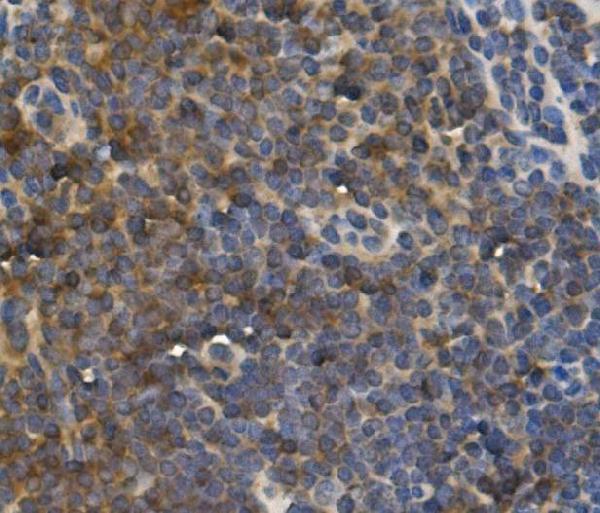 m00021 1 il 10 primary antibodies ihc testing 3