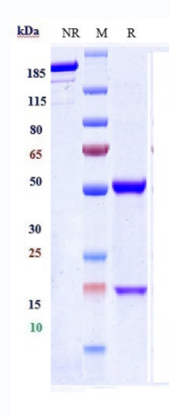 Anti-IL-10 Reference Antibody (BT-063) on SDS-PAGE under reducing (R) condition