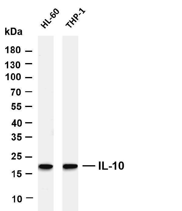 Various whole cell lysates were separated by 4-20% SDS-PAGE, and the membrane was blotted with anti-IL-10 antibody