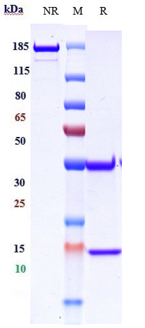 m00023 14 sds page