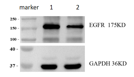 m00023 2 egfr primary antibodies wb review 1_2