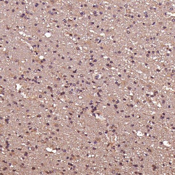 m00023 2 ihc10