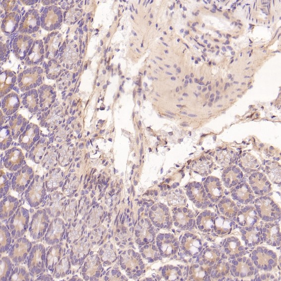 m00023 2 ihc11