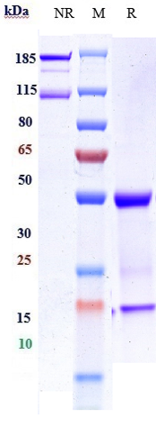 m00023 21 sds page