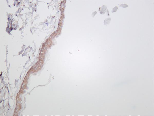 m00023 30 egfr primary antibodies ihc testing 1