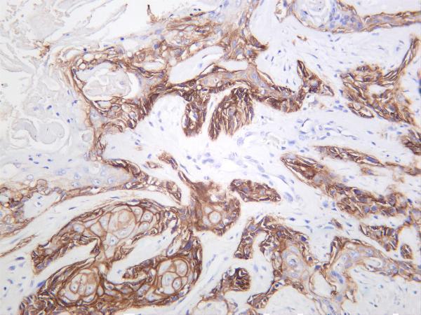 m00023 30 egfr primary antibodies ihc testing 2