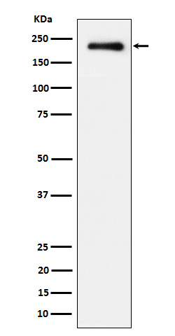 Western blot analysis of Phospho-EGFR (Y869) expression in A431 treated with EGF cell lysate