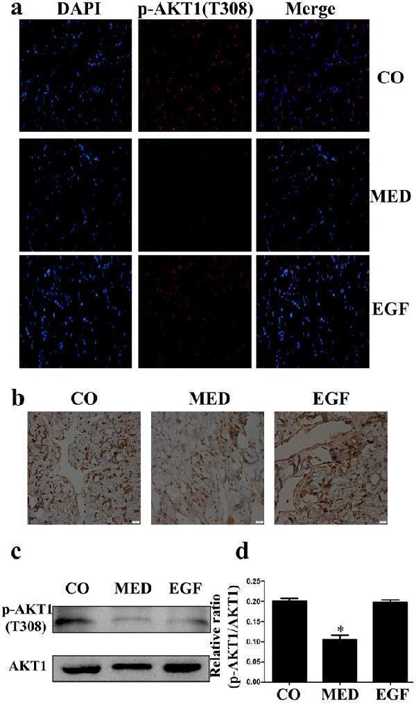 ( a ) Immunofluorescence staining of cavernous tissue using an antibody against p-Akt1(Tyr308) in the CO, MED and EGF groups