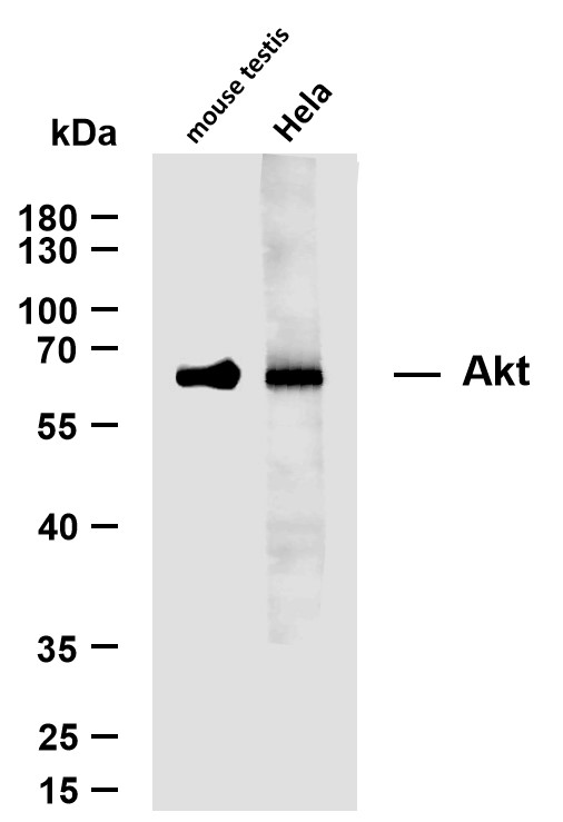 Various whole cell lysates were separated by 10% SDS-PAGE, and the membrane was blotted with anti-AKT antibody