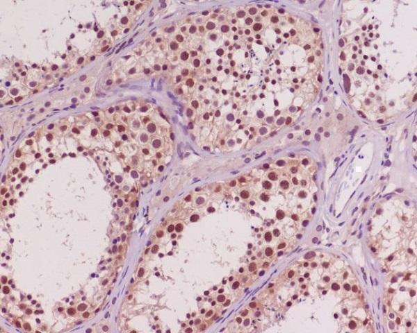 m00024 5 ihc