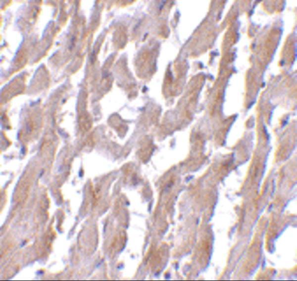 Immunohistochemistry of MyD88 in human heart with MyD88 antibody at 2