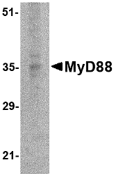 Western blot analysis of MyD88 in EL4 whole cell lysate with MyD88 antibody at 2 μg/mL