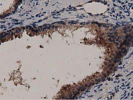 Immunohistochemical staining of paraffin-embedded Human prostate tissue within the normal limits using anti-MYD88 mouse monoclonal antibody