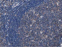 m00025 3 anti myd88 mouse monoclonal antibody clone id oti2b2 ihc testing 5
