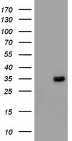 HEK293T cells were transfected with the pCMV6-ENTRY control (Left lane) or pCMV6-ENTRY MYD88 (Right lane) cDNA for 48 hrs and lysed