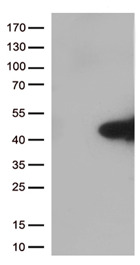 HEK293T cells were transfected with the pCMV6-ENTRY control (Left lane) or pCMV6-ENTRY MYD88 (Right lane) cDNA for 48 hrs and lysed