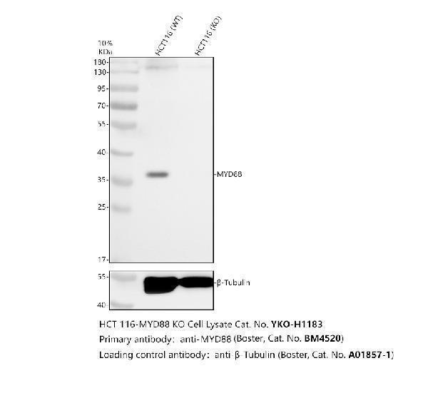 Western blot analysis of MYD88 using anti-MYD88 antibody (M00025)