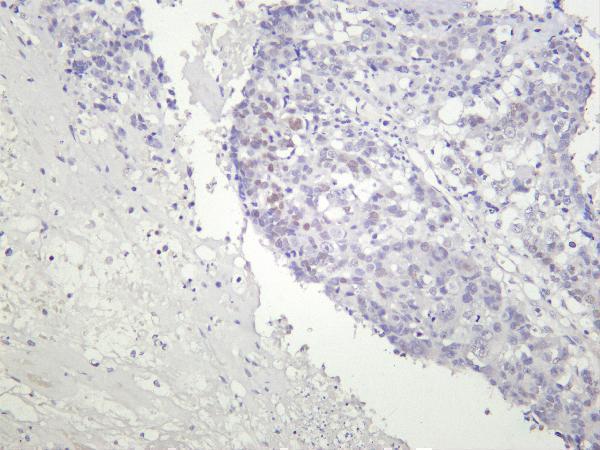 Human lung was stained with Anti-c-Myc rabbit antibody