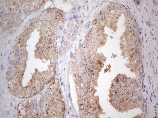 m00027 1 anti jak2 mouse monoclonal antibody clone id oti7d12 ihc testing 1