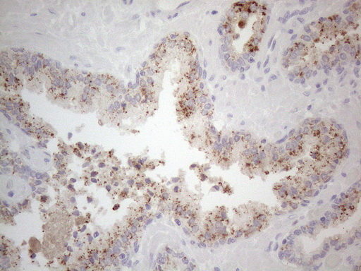 m00027 1 anti jak2 mouse monoclonal antibody clone id oti7d12 ihc testing 2
