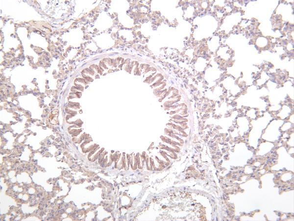 Mouse lung was stained with anti-JAK2 rabbit antibody