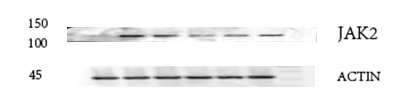  Western blot analysis of JAK2 using anti-JAK2 antibody (M00027)