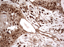 m00029 1 anti pi 3 kinase catalytic subunit alpha pik3ca mouse monoclonal antibody clone id oti6d9 ihc testing 1