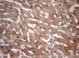m00029 1 anti pi 3 kinase catalytic subunit alpha pik3ca mouse monoclonal antibody clone id oti6d9 ihc testing 10