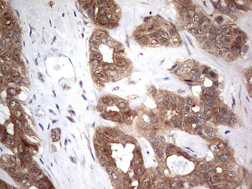 m00029 1 anti pi 3 kinase catalytic subunit alpha pik3ca mouse monoclonal antibody clone id oti6d9 ihc testing 11