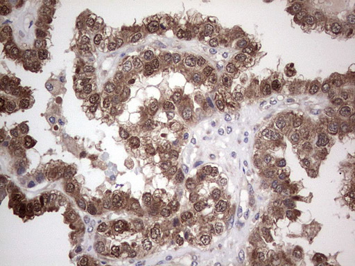 m00029 1 anti pi 3 kinase catalytic subunit alpha pik3ca mouse monoclonal antibody clone id oti6d9 ihc testing 2