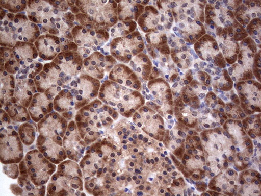 m00029 1 anti pi 3 kinase catalytic subunit alpha pik3ca mouse monoclonal antibody clone id oti6d9 ihc testing 3