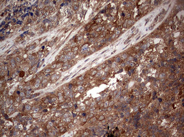 m00029 1 anti pi 3 kinase catalytic subunit alpha pik3ca mouse monoclonal antibody clone id oti6d9 ihc testing 4