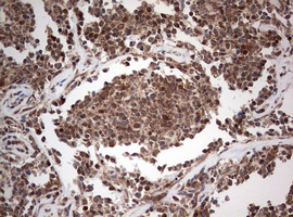 m00029 1 anti pi 3 kinase catalytic subunit alpha pik3ca mouse monoclonal antibody clone id oti6d9 ihc testing 5