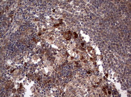 m00029 1 anti pi 3 kinase catalytic subunit alpha pik3ca mouse monoclonal antibody clone id oti6d9 ihc testing 6