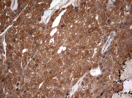 m00029 1 anti pi 3 kinase catalytic subunit alpha pik3ca mouse monoclonal antibody clone id oti6d9 ihc testing 7