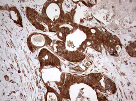 m00029 1 anti pi 3 kinase catalytic subunit alpha pik3ca mouse monoclonal antibody clone id oti6d9 ihc testing 8
