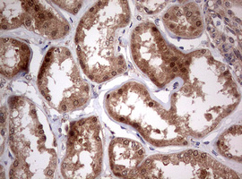 m00029 1 anti pi 3 kinase catalytic subunit alpha pik3ca mouse monoclonal antibody clone id oti6d9 ihc testing 9