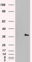HEK293T cells were transfected with the pCMV6-ENTRY control (Left lane) or pCMV6-ENTRY MAPK1 (Right lane) cDNA for 48 hrs and lysed