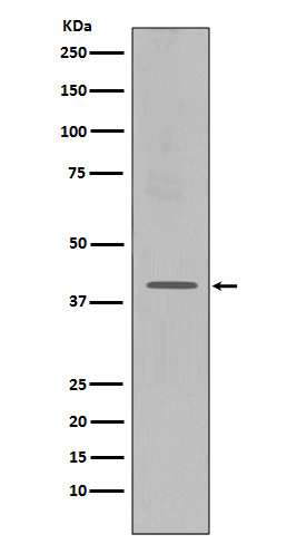 Western blot analysis of CXCR4 expression in Jurkat cell lysate