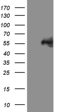 HEK293T cells were transfected with the pCMV6-ENTRY control (Left lane) or pCMV6-ENTRY MYCN (Right lane) cDNA for 48 hrs and lysed