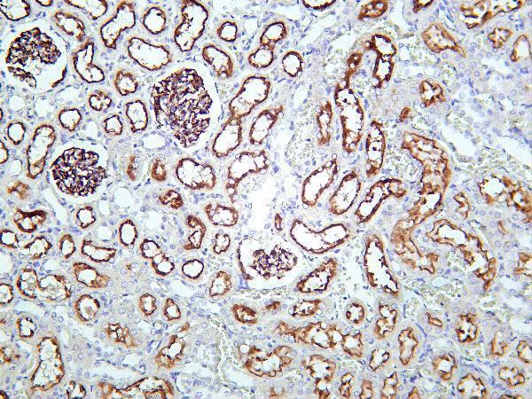 Rat kidney tissue was stained with Anti-NLRP3 rabbit Antibody