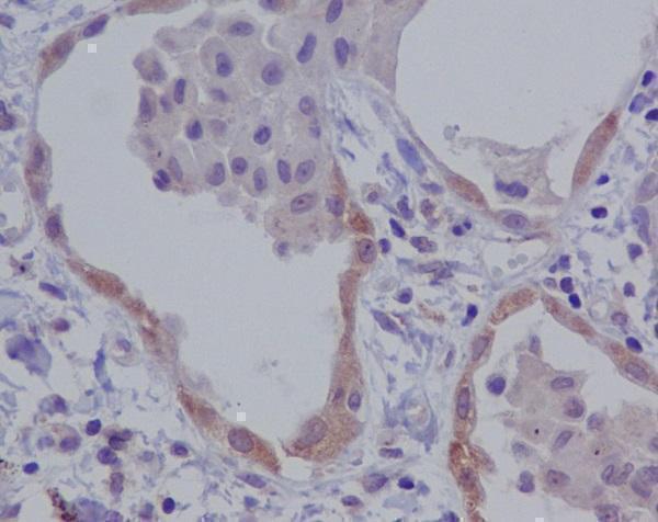m00034 ihc