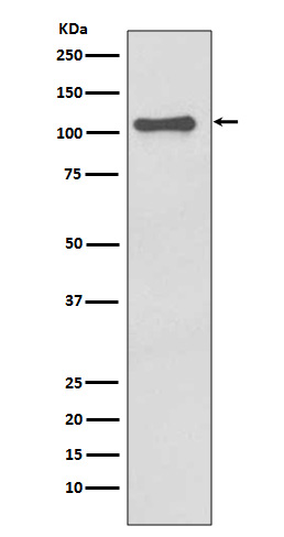 Western blot analysis of NLRP3 expression in SH-SY5Y cell lysate