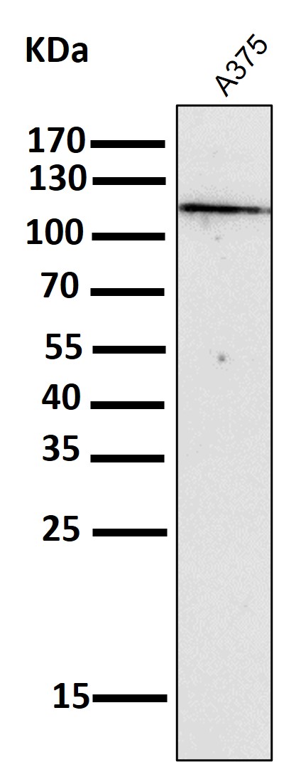 All lanes use the Antibody at 1:2K dilution for 1 hour at room temperature