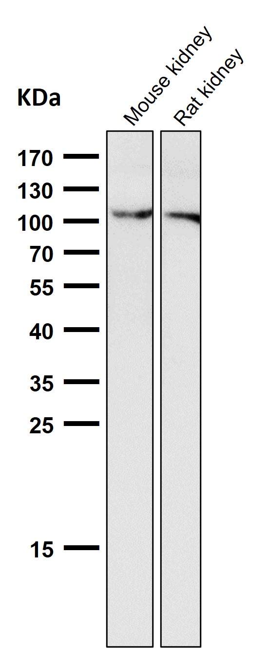 All lanes use the Antibody at 1:1K dilution for 1 hour at room temperature