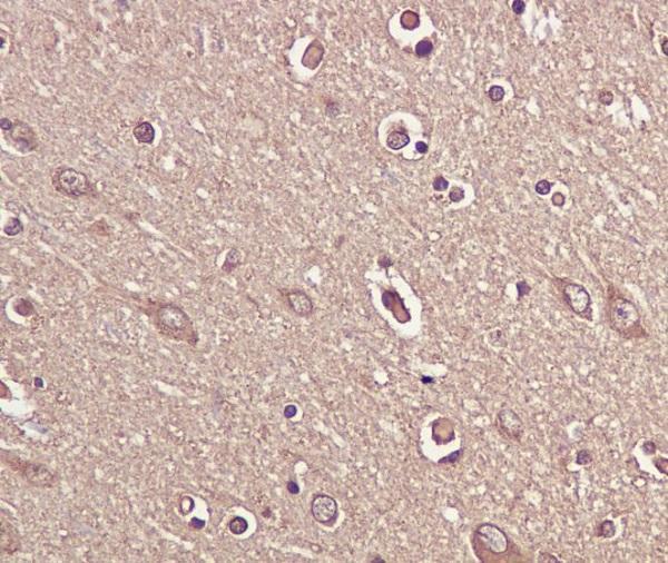m00035 2 ihc