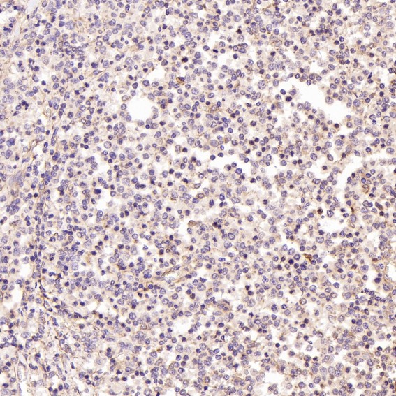 m00035 2 ihc7