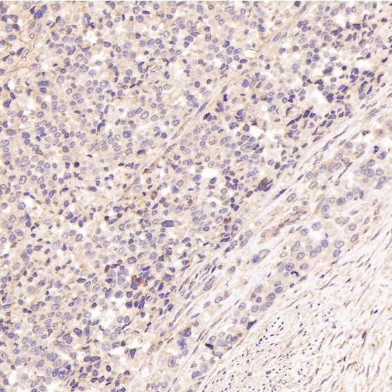 m00035 2 ihc8